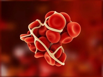 Tìm hiểu về cục máu đông: nguyên nhân, triệu chứng, cách điều trị