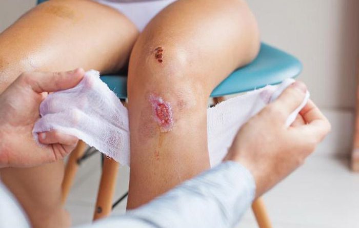 Tại sao vết thương lâu lành?