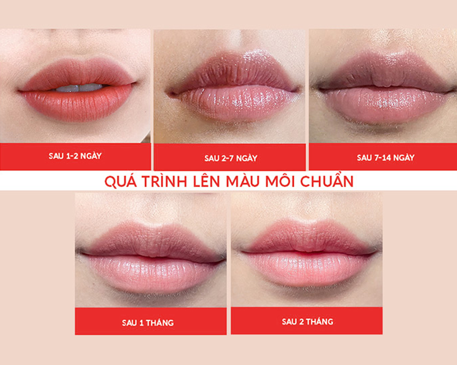 Phun môi xong cần uống gì, kiêng gì, bôi gì? Chăm sóc đúng để môi không bị thâm