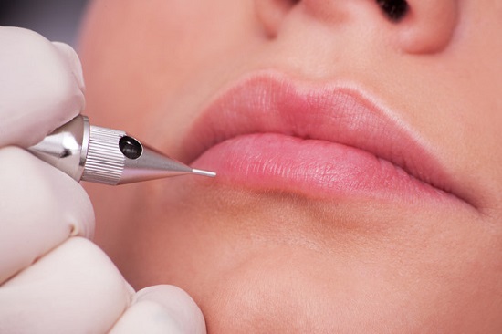 Màu môi lên không đều, không chuẩn màu – Có phải do cơ địa hay quá trình hồi phục?